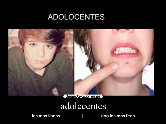 adolecentes - los mas lindos                     |                  con los mas feos