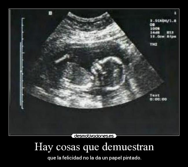 Hay cosas que demuestran - 