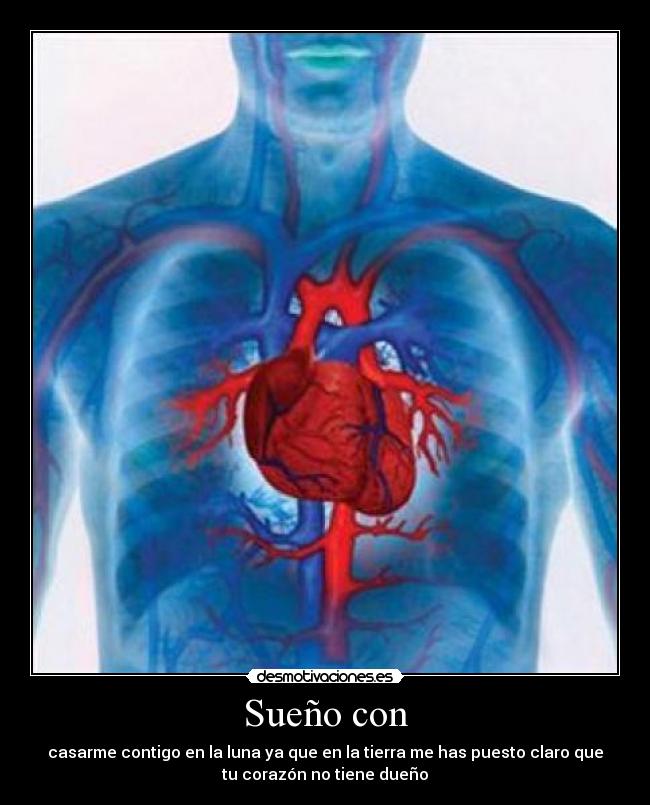 Sueño con - 
