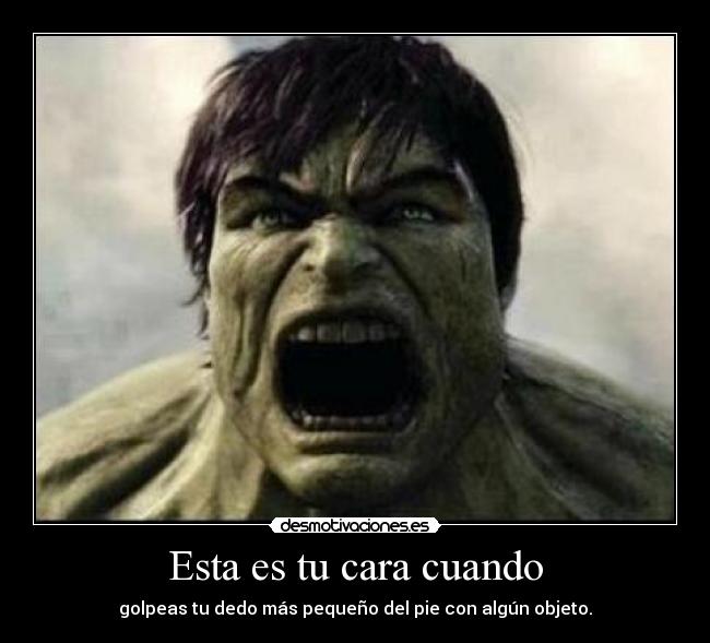 Esta es tu cara cuando - golpeas tu dedo más pequeño del pie con algún objeto.