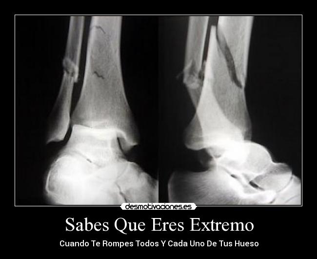 carteles yea desmotivaciones