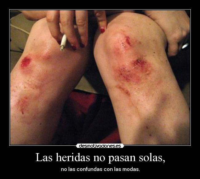 Las heridas no pasan solas, - no las confundas con las modas.