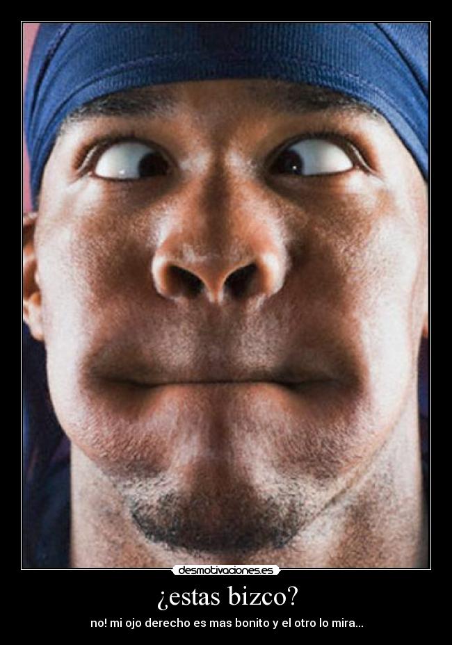 ¿estas bizco? - no! mi ojo derecho es mas bonito y el otro lo mira...