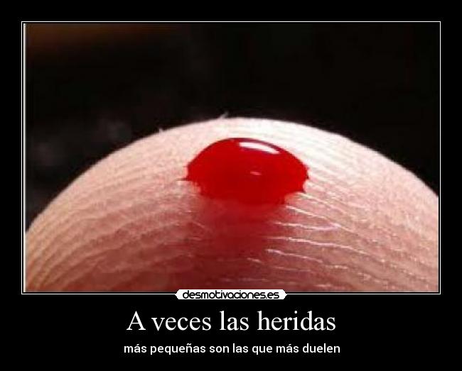 A veces las heridas -