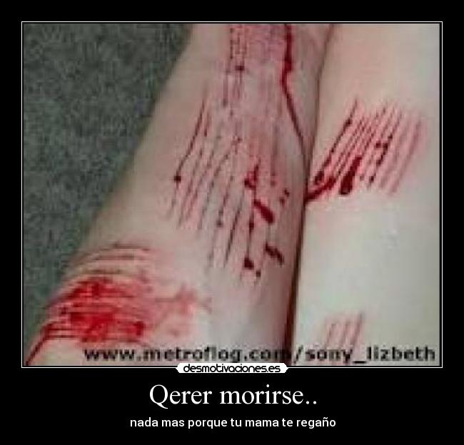 Qerer morirse.. -
