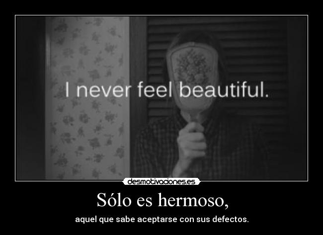 Sólo es hermoso, - aquel que sabe aceptarse con sus defectos.