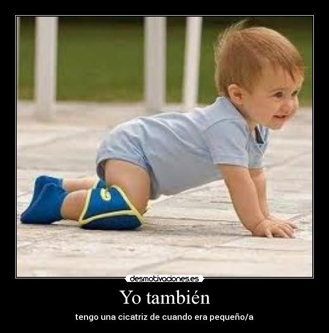 Yo también -