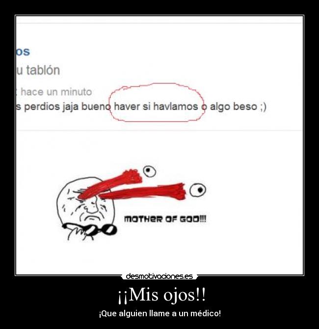 ¡¡Mis ojos!! - ¡Que alguien llame a un médico!