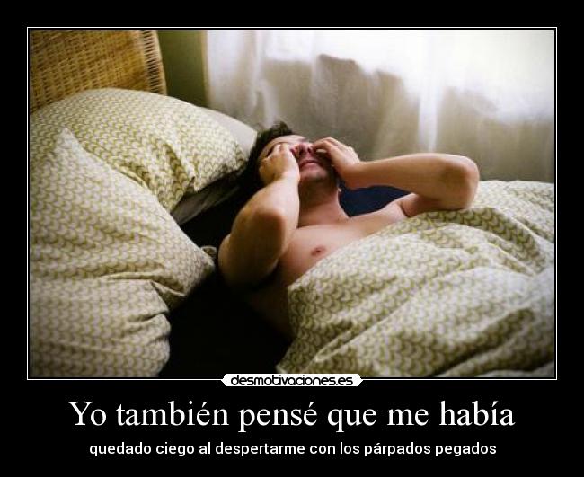 Yo también pensé que me había - quedado ciego al despertarme con los párpados pegados