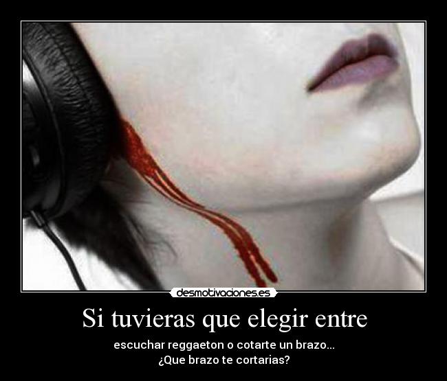 Si tuvieras que elegir entre - escuchar reggaeton o cotarte un brazo...
¿Que brazo te cortarias?