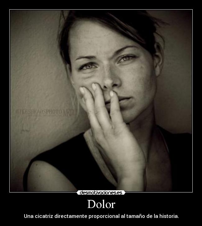 Dolor - Una cicatriz directamente proporcional al tamaño de la historia.