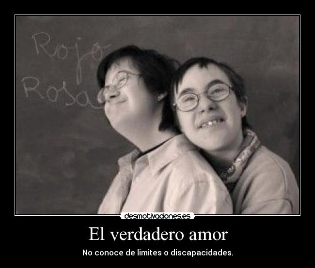 El verdadero amor - No conoce de limites o discapacidades.