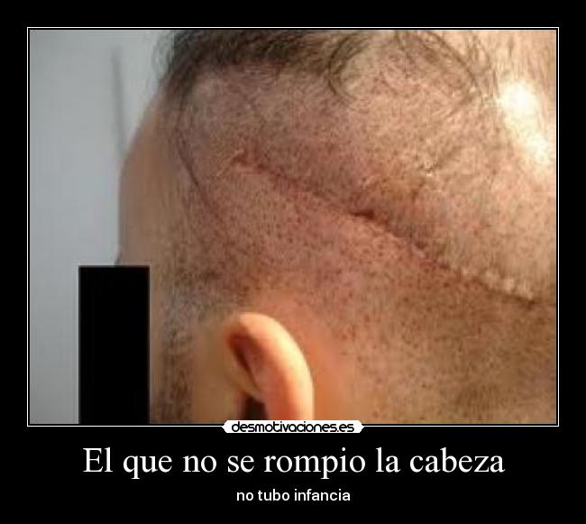 El que no se rompio la cabeza -