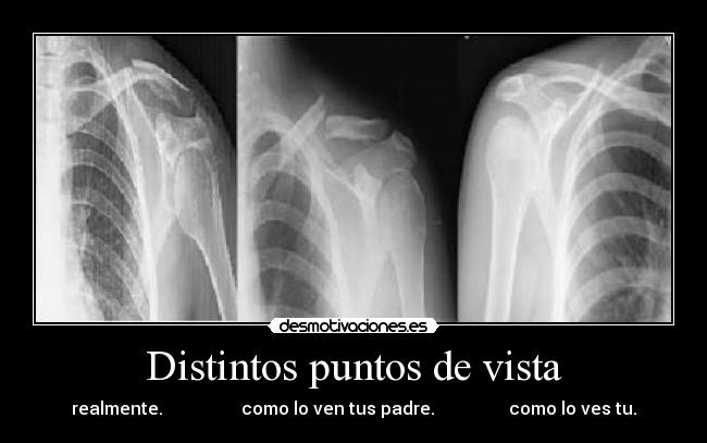 Distintos puntos de vista - realmente. como lo ven tus padre. como lo ves tu.