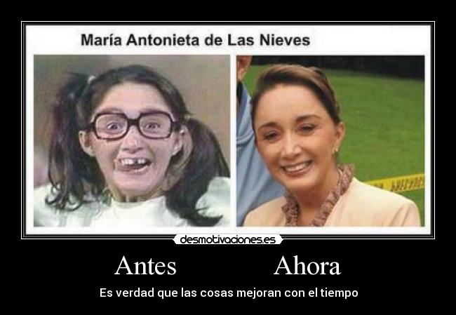 Antes              Ahora - Es verdad que las cosas mejoran con el tiempo