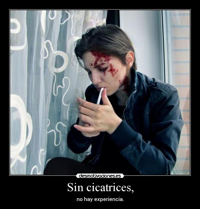 Sin cicatrices, - no hay experiencia.