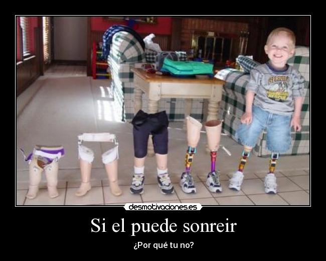 Si el puede sonreir - 