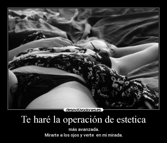 Te haré la operación de estetica -