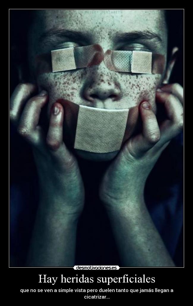 Hay heridas superficiales -
