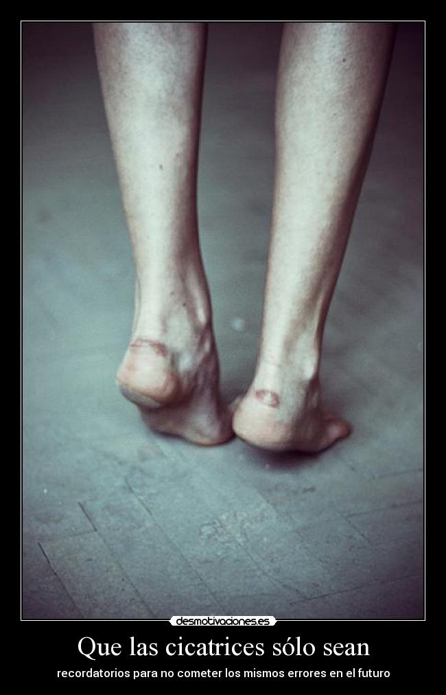 Que las cicatrices sólo sean - recordatorios para no cometer los mismos errores en el futuro