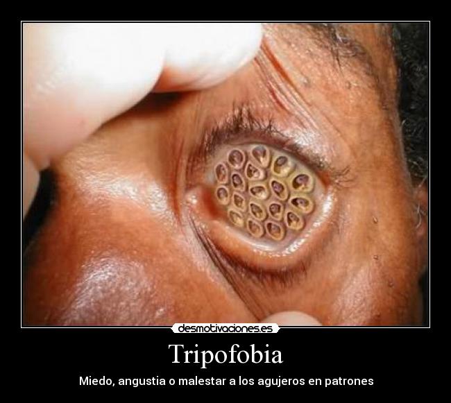 Tripofobia - 