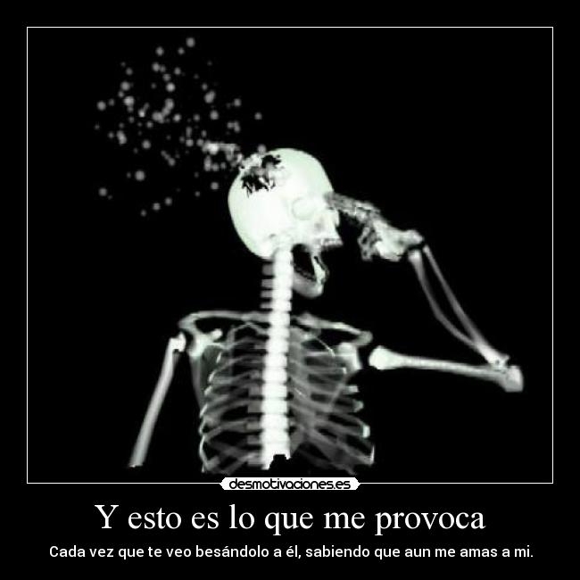 Y esto es lo que me provoca - 