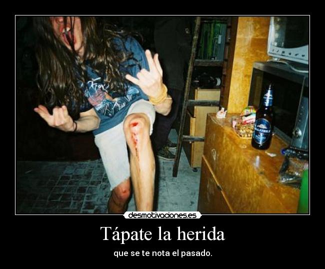 Tápate la herida -