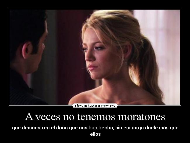 A veces no tenemos moratones - 
