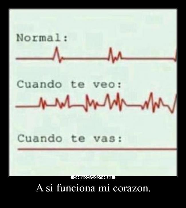 A si funciona mi corazon. - 