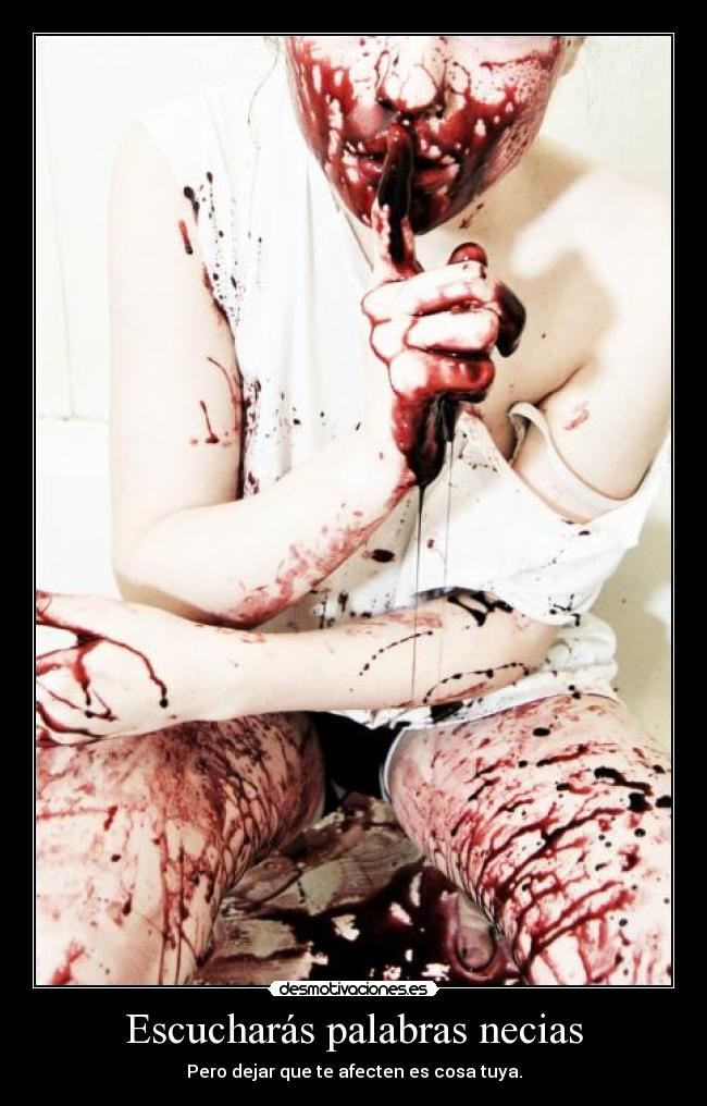 Escucharás palabras necias - 