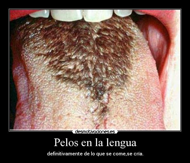 Pelos en la lengua -