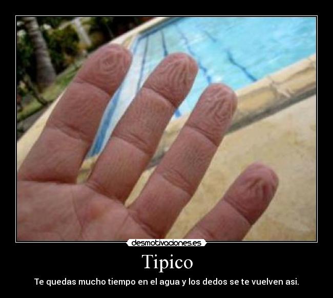 Tipico -