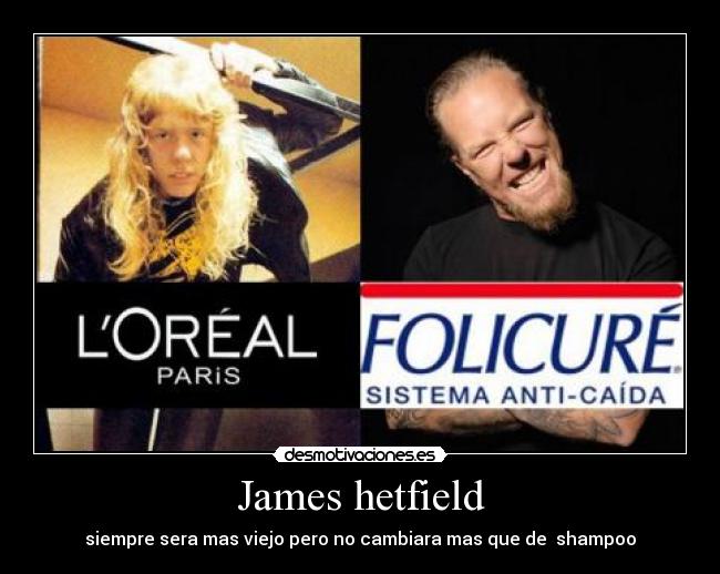 James hetfield - siempre sera mas viejo pero no cambiara mas que de shampoo