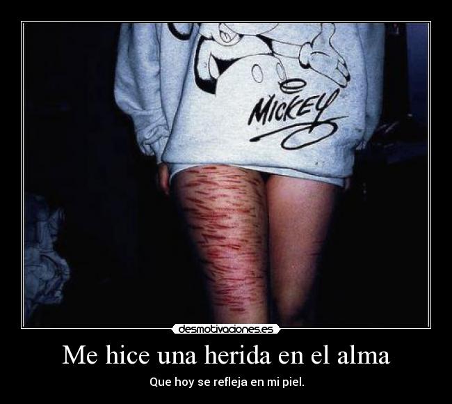 Me hice una herida en el alma -