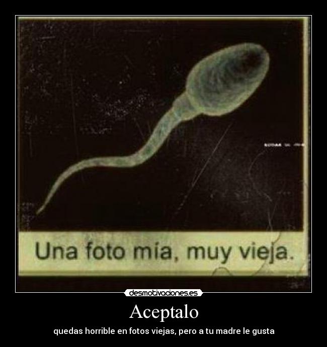 Aceptalo - quedas horrible en fotos viejas, pero a tu madre le gusta