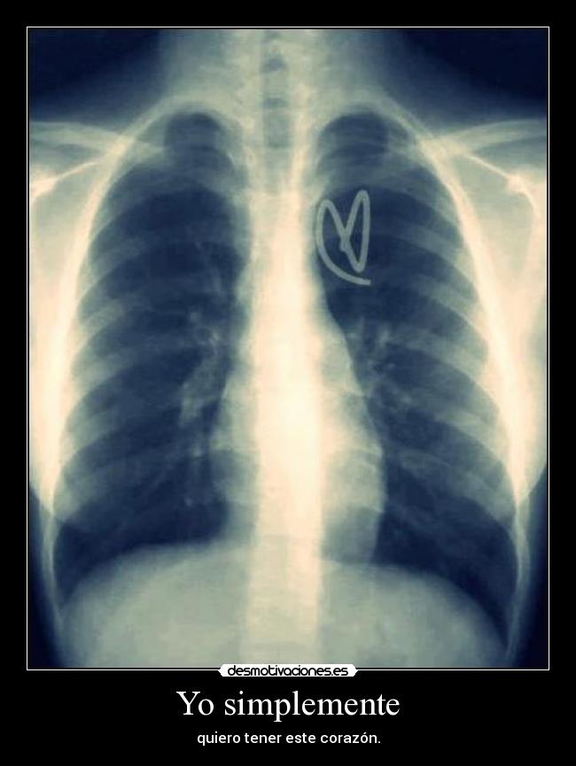 Yo simplemente - quiero tener este corazón.