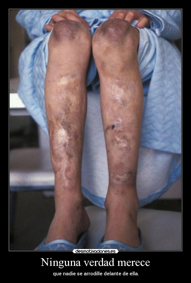 Ninguna verdad merece - que nadie se arrodille delante de ella.