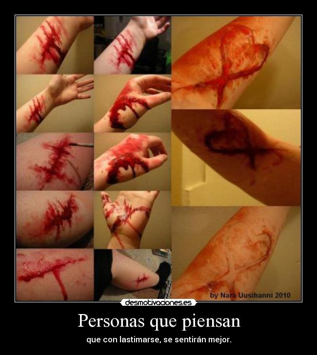 Personas que piensan - que con lastimarse, se sentirán mejor.