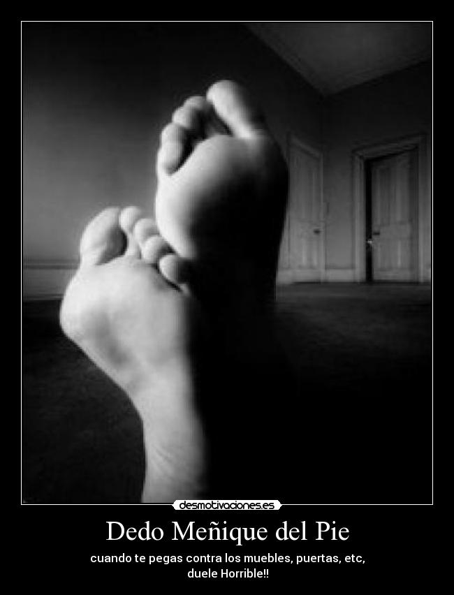 Dedo Meñique del Pie - cuando te pegas contra los muebles, puertas, etc,
duele Horrible!!