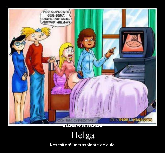 Helga - Nesesitará un trasplante de culo.