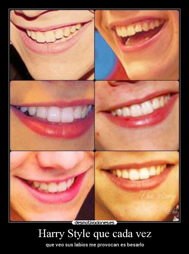 Harry Style que cada vez - que veo sus labios me provocan es besarlo