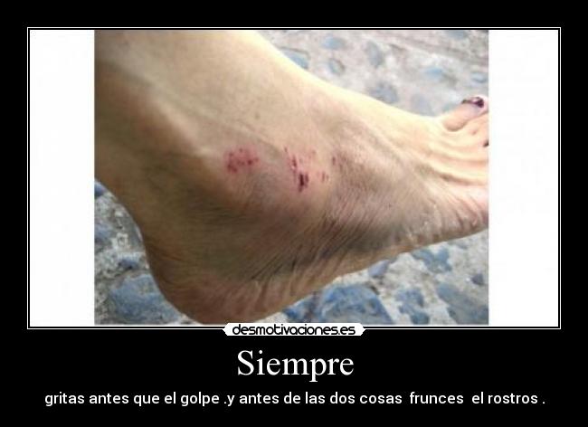 Siempre - gritas antes que el golpe .y antes de las dos cosas frunces el rostros .