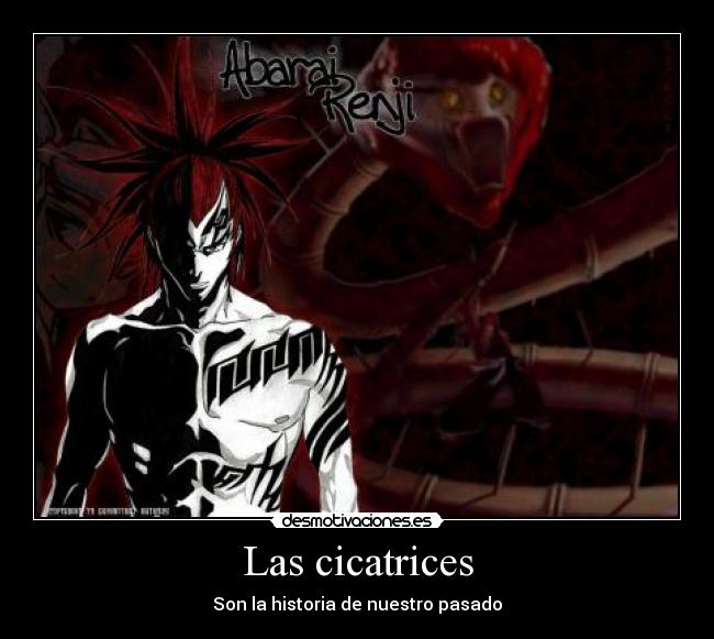 Las cicatrices - Son la historia de nuestro pasado