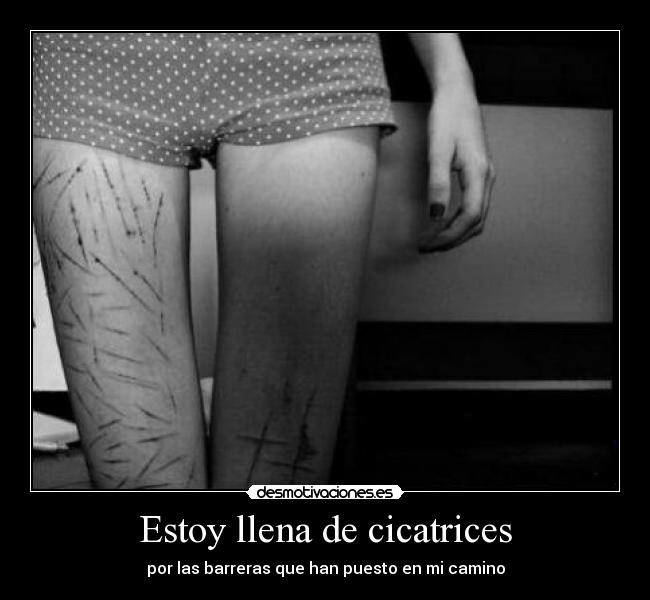 Estoy llena de cicatrices - 