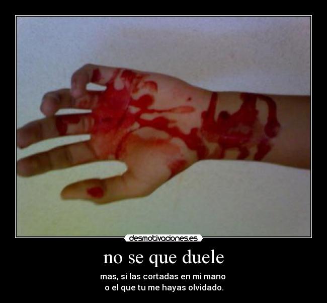 no se que duele - mas, si las cortadas en mi mano
o el que tu me hayas olvidado.