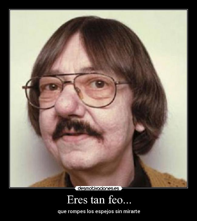 Eres tan feo... -
