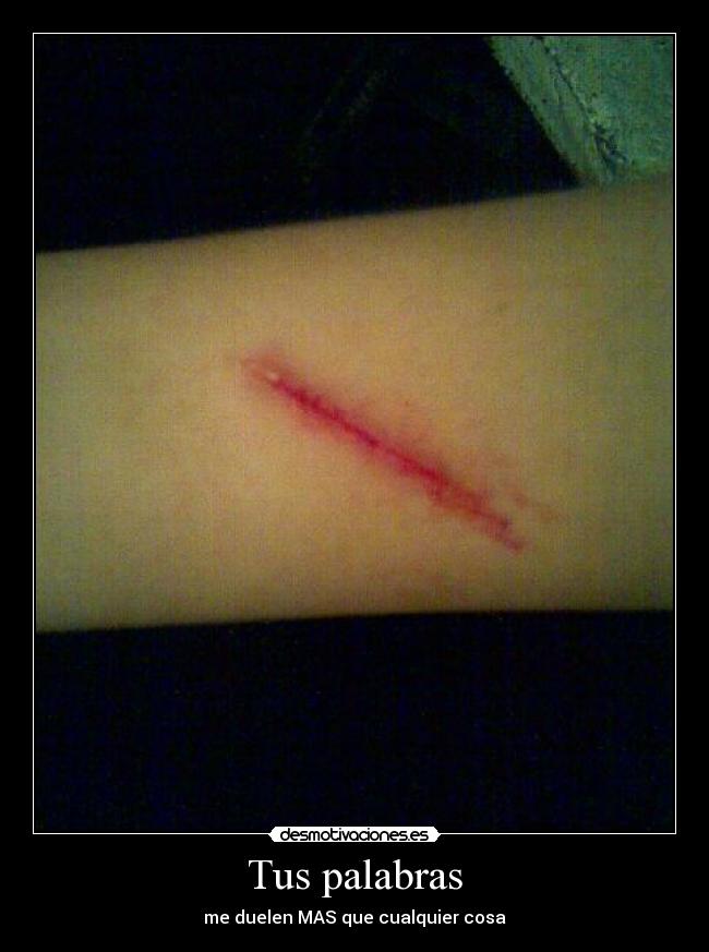 Tus palabras - me duelen MAS que cualquier cosa