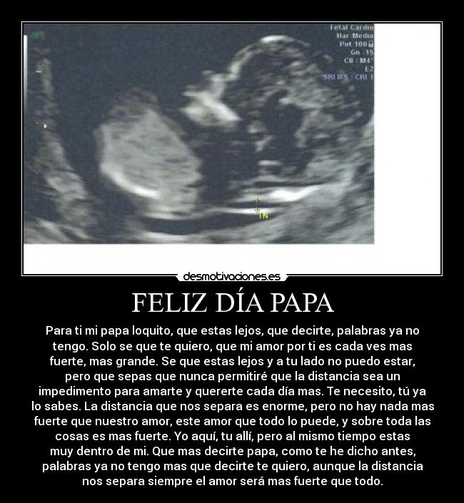 FELIZ DÍA PAPA - Para ti mi papa loquito, que estas lejos, que decirte, palabras ya no
tengo. Solo se que te quiero, que mi amor por ti es cada ves mas
fuerte, mas grande. Se que estas lejos y a tu lado no puedo estar,
pero que sepas que nunca permitiré que la distancia sea un
impedimento para amarte y quererte cada día mas. Te necesito, tú ya
lo sabes. La distancia que nos separa es enorme, pero no hay nada mas
fuerte que nuestro amor, este amor que todo lo puede, y sobre toda las
cosas es mas fuerte. Yo aquí, tu allí, pero al mismo tiempo estas
muy dentro de mi. Que mas decirte papa, como te he dicho antes,
palabras ya no tengo mas que decirte te quiero, aunque la distancia
nos separa siempre el amor será mas fuerte que todo.