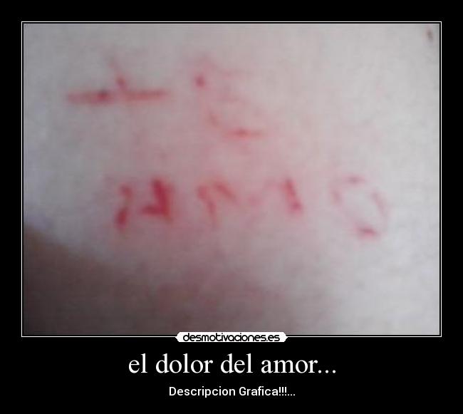 el dolor del amor... - Descripcion Grafica!!!...