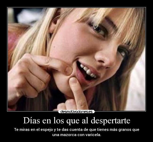Días en los que al despertarte - Te miras en el espejo y te das cuenta de que tienes más granos que
una mazorca con varicela.